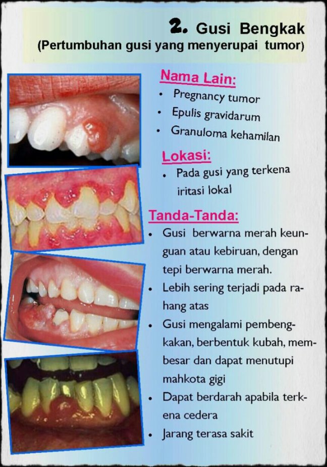 3-1_Perga-1.jpg image